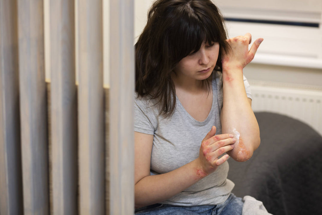 The Importance of Preventing Fungal Infections Naturally - Sisquoc Healthcare