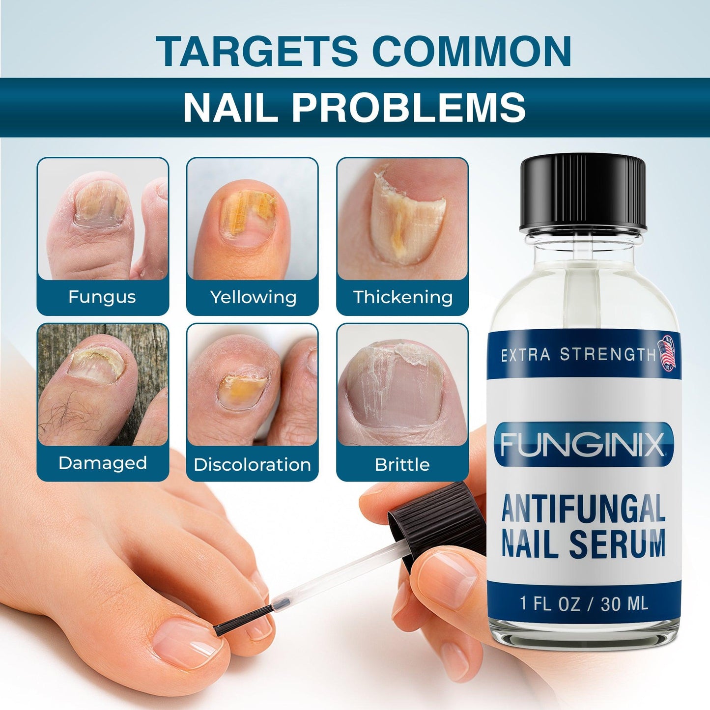 FUNGINIX - Extra Strength Toenail Fungus Treatment.