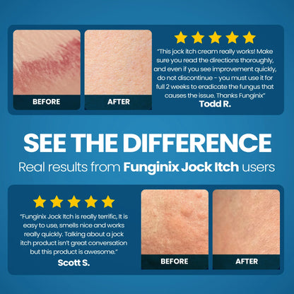 FUNGINIX Jock Itch Treatment - Relieves Itching, Burning, Scaling, and Chafing, Natural Anti Itch Treatment with Tolnaftate (1 Ounce) - Sisquoc Healthcare