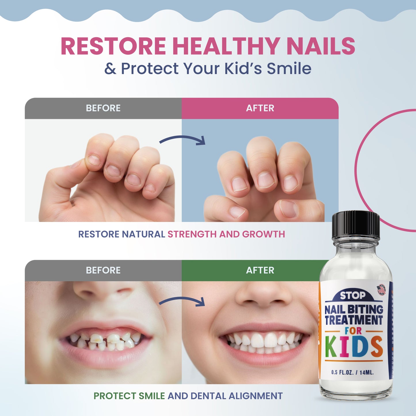 KIDS STOP NAIL BITING — Bitter Taste Nail Biting Deterrent for Kids