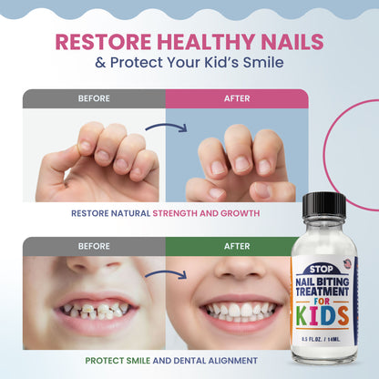 KIDS STOP NAIL BITING — Bitter Taste Nail Biting Deterrent for Kids