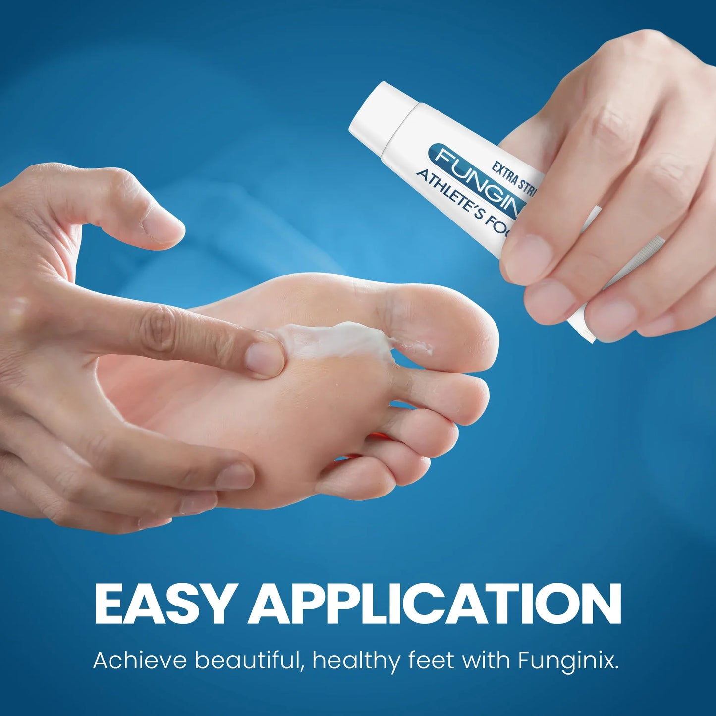 FUNGINIX AF Athletes Foot Cream - Topical Anti-Fungal Treatment, Eliminates Athlete's Foot Infections, Safe & Effective (1 Ounce) - Sisquoc Healthcare
