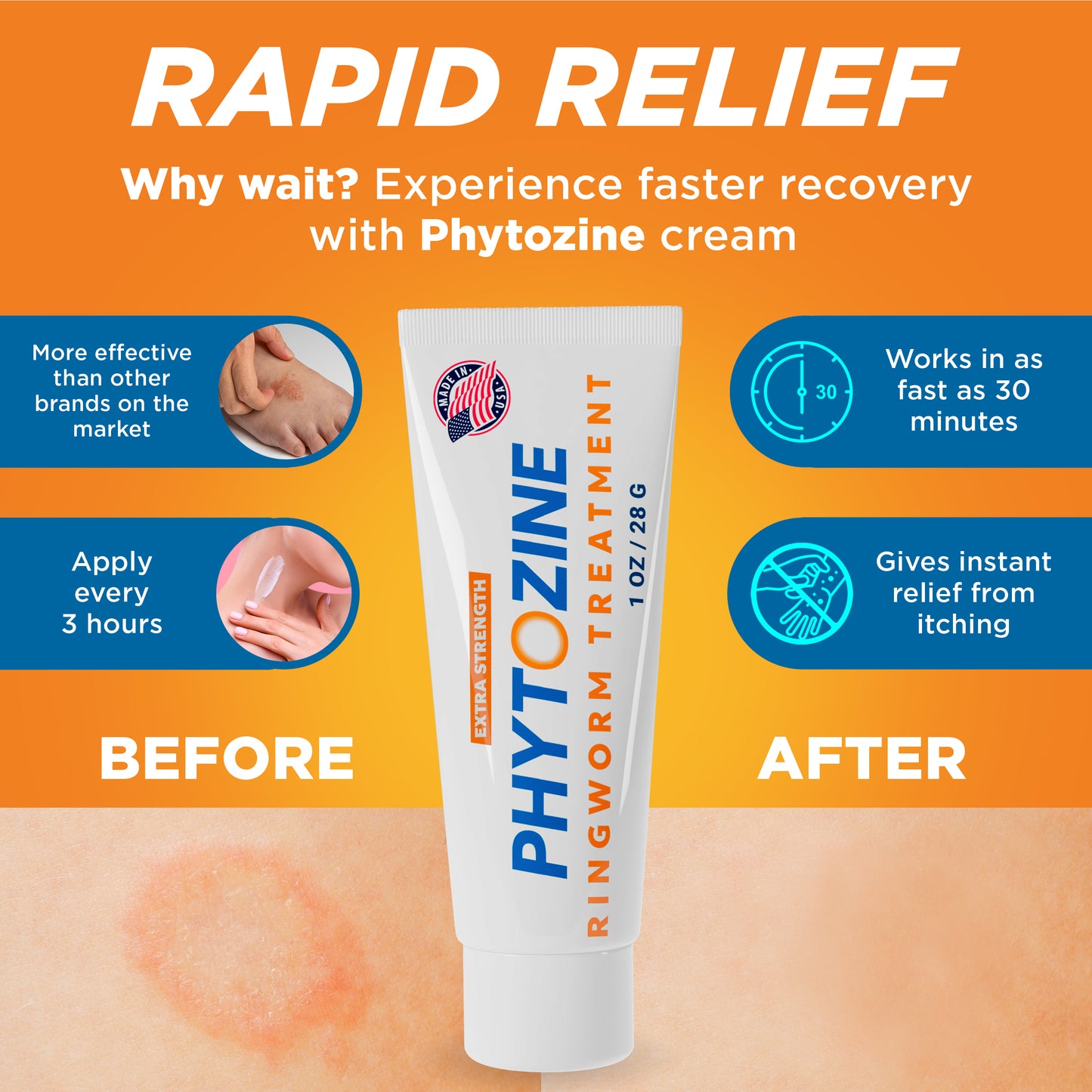 PHYTOZINE Anti Fungal Cream for Skin with 1% Tolnaftate - Ringworm Treatment for Humans - Effective Athletes Foot Treatment Cream